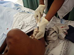 new somerset hospital - draining a pneumothorax IMGP5152.JPG